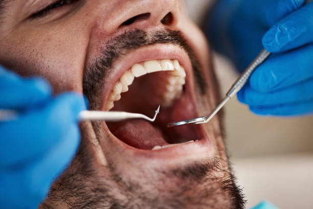 Best Emergency Dental Care for Abscessed Tooth in Pea Ridge, AR